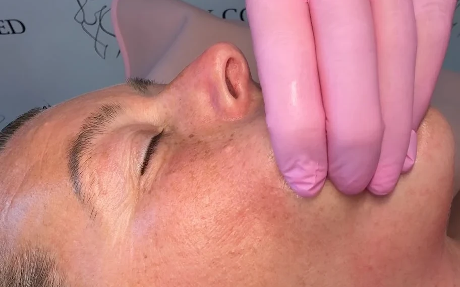 Lymphatic Buccal Intraoral Facial